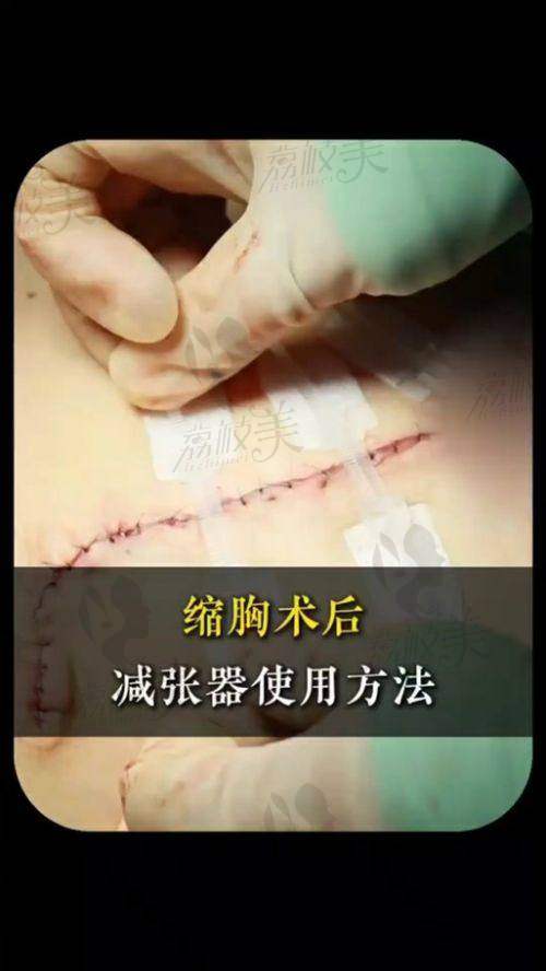 中山贝熙医疗美容真人实例：16800元的美丽蜕变