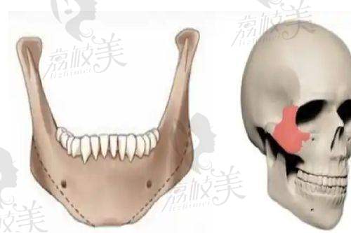 苏州美诗沁去眼袋正规吗？看看有哪些去眼袋项目