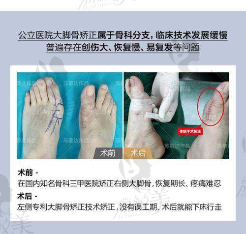 李春明医生技术特点：