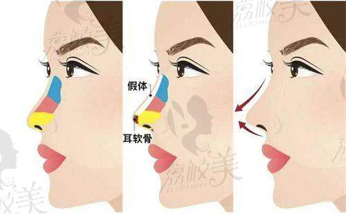 苏州美丽莱恩医疗美容诊所地址及乘车路线：