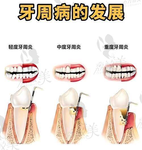 沈刚在哪家医院？