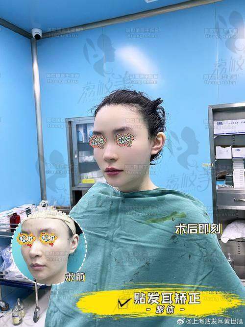 北京漾格注射精灵耳价格分阶是怎样的？