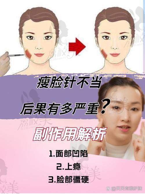 邢志花医生在瘦脸针领域有怎样的专精实力？