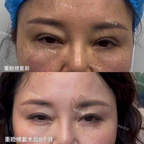 复旦背景+4000台手术经验，张楚修复不是“学出来”的，而是手术台上练出来的