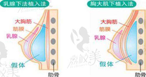 罗会良医生技术特点：