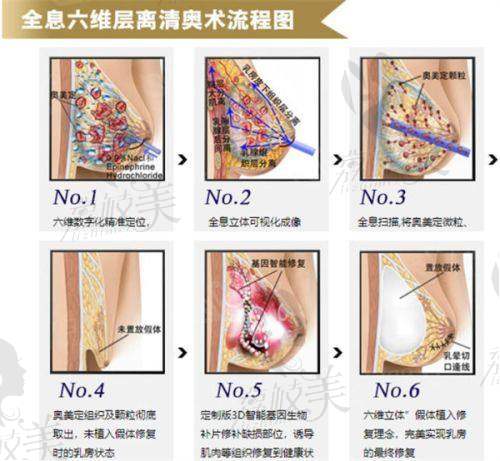 芜湖伊莱美整形曹闪妹皮秒祛斑技术优势
