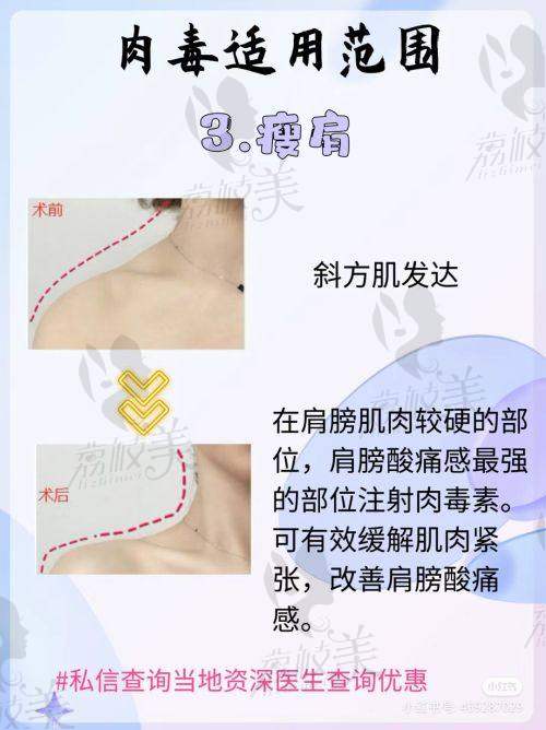 芜湖伊莱美整形曹闪妹优质服务保护