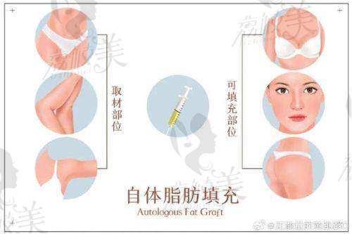 袁玉坤的价格为什么比特别多机构医生贵？是否值得？