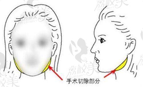 陈政军 医生口碑怎么样？