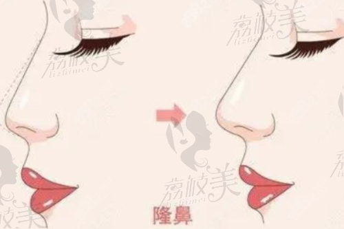 张辉医生都做哪些鼻部项目？价格是多少？