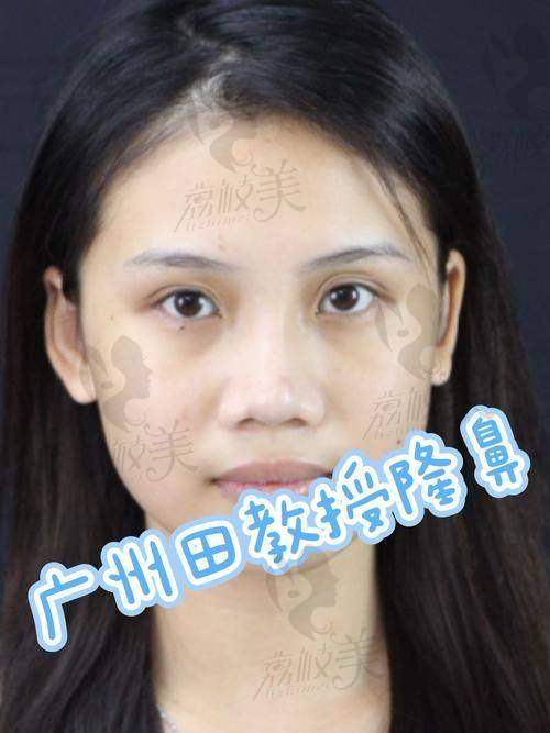 为什么说张辉医生注重功能+美学的双平衡？