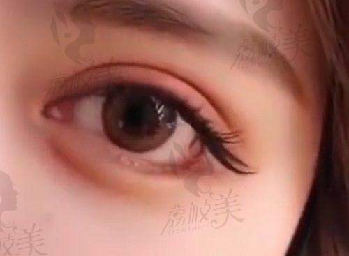 北京姬东硕很难约吗？梳理出诊信息、预约方式，看他为何让大家排队等待！
