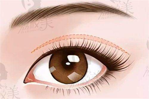 叶明龙医生鼻综合项目价格详情