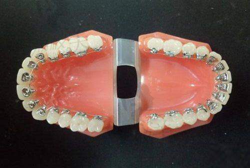 【上海朱荷兰口腔诊所怎么预约挂号】