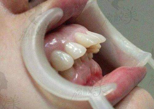 【上海朱荷兰口腔诊所仪器设备有哪些】
