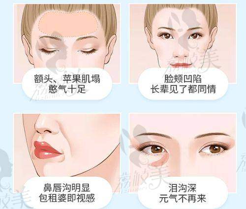 选择叶明龙医生鼻综合项目的理由