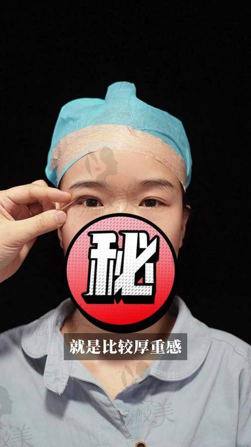 姬东硕做的面部整形项目：眼鼻实例呼声高，小脸打造尤为抢手