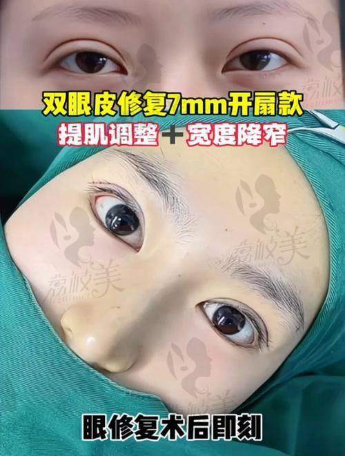 她的患者都在追哪些项目？