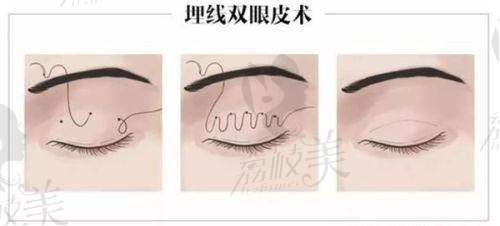 刘辅容医生简介