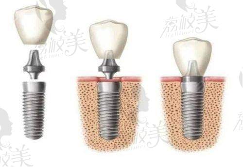 【重庆众植博仕口腔门诊部（巴南店）仪器设备有哪些】