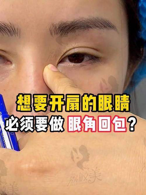 刘辅容眼角修复怎么样？自然派审美定制方案，眼角回缩率远低于行业水平！