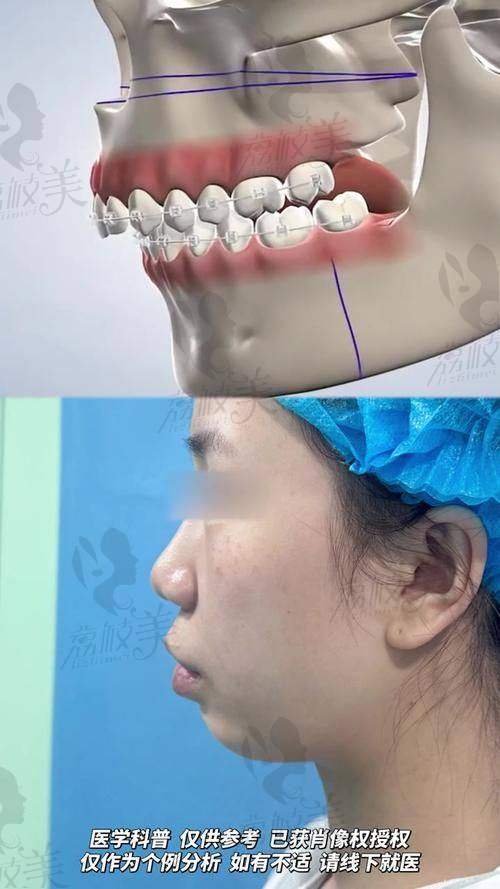 穆雄铮成功实例火辣曝光：那些夸他的人真实照片都在说话！