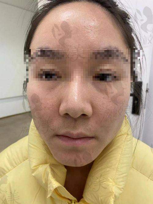 张立彬医生擅长项目