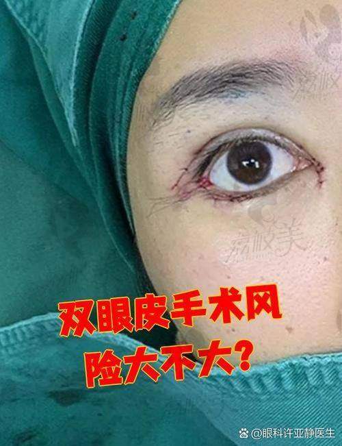 术后修复期长不长？需要注意什么？