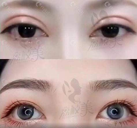 成都刘辅容医院地址一览：正规眼整形机构，多种预约途径开启美丽之旅！