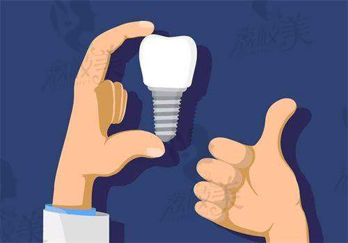 植体适应人群广吗?是否适合我使用?