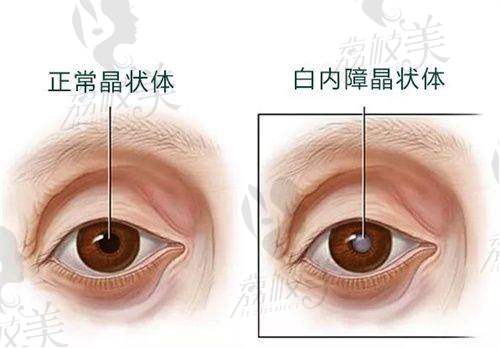 杨东雷医生的擅长项目到底怎么样？