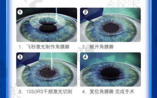 徐州矿西眼科医院是正规的吗？