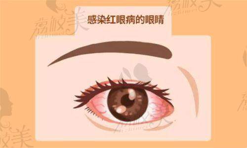 南宁爱尔眼科园湖门诊部医生名单：