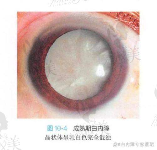 杨东雷医生技术特点