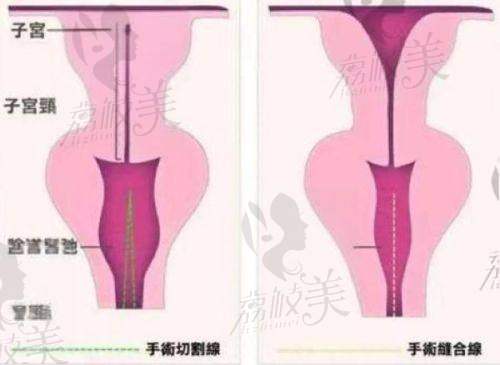 深圳富华医疗美容医院是几级医院？技术与设备优势