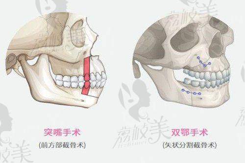 手术技术特色