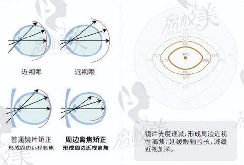 大连瓦房店何氏眼科医院口碑怎么样？