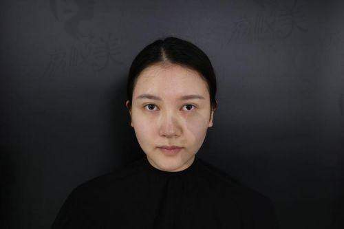 哪些医生擅长濡白天使针打鼻子？