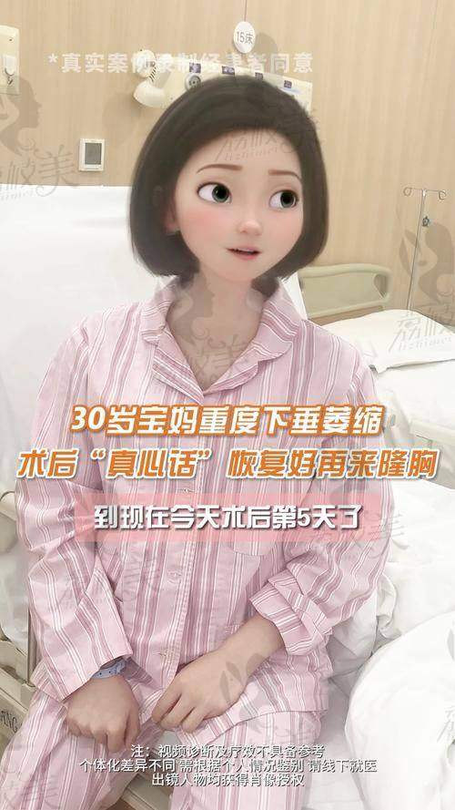总结：值不值？如果你追求“胸型提拉+自然感”，它值得！