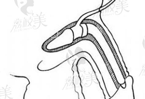 九龙男科为什么收费那么贵？——精良的技术与设备保护成效