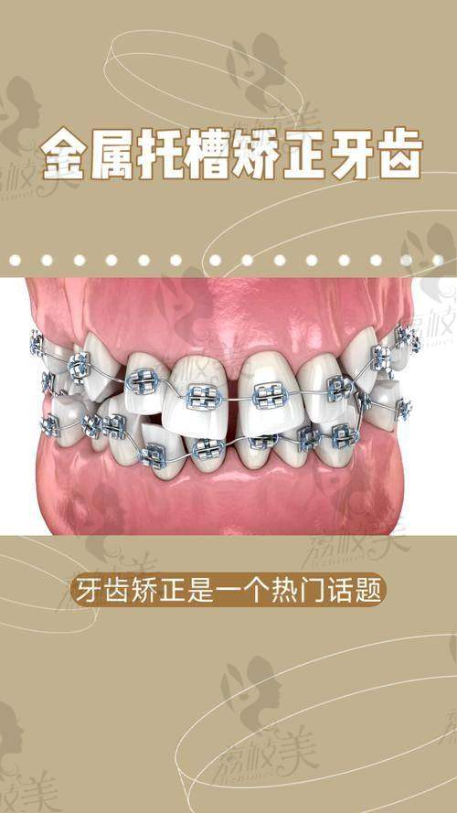 漳州呀哚口腔传统成人牙齿矫正价格7999元起，整牙不将“就” 咬字有腔调人生更出挑