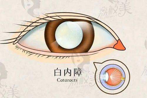 谭辉医生技术特点：稳、准、柔，操作耐看！