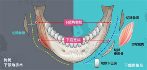 沈海琳医生怎么预约挂号？