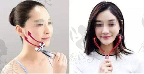 揭秘上海星璨李海涛筋膜大拉皮：10年长效抗衰，3万起重塑自然年轻态！
