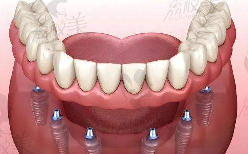 姐妹们!下面这些城市德韩口腔价格也特别“上头”