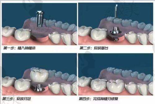 【武汉南星口腔门诊部（湘隆总店）技术特点】