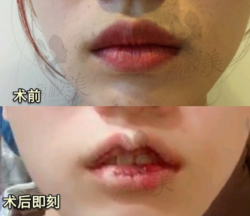 成都晶肤医疗美容连锁(天府长城院)特色项目：