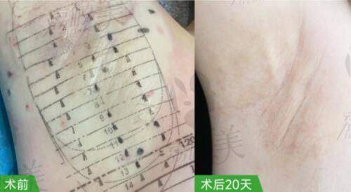 成都晶肤医疗美容连锁(铁像寺水街院)是正规的吗？