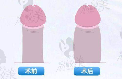 成都军大医院汪雅医生特色技术优势