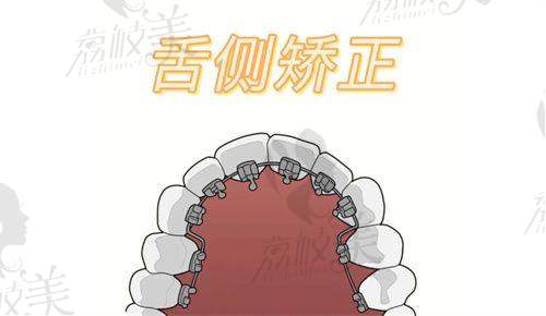 任翀医生：擅长项目，就跟刷牙一样熟练